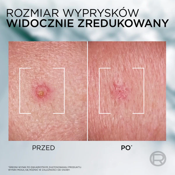 Zdjęcie produktu 4