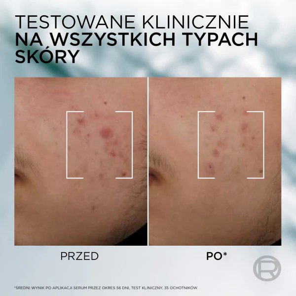 Zdjęcie produktu 2