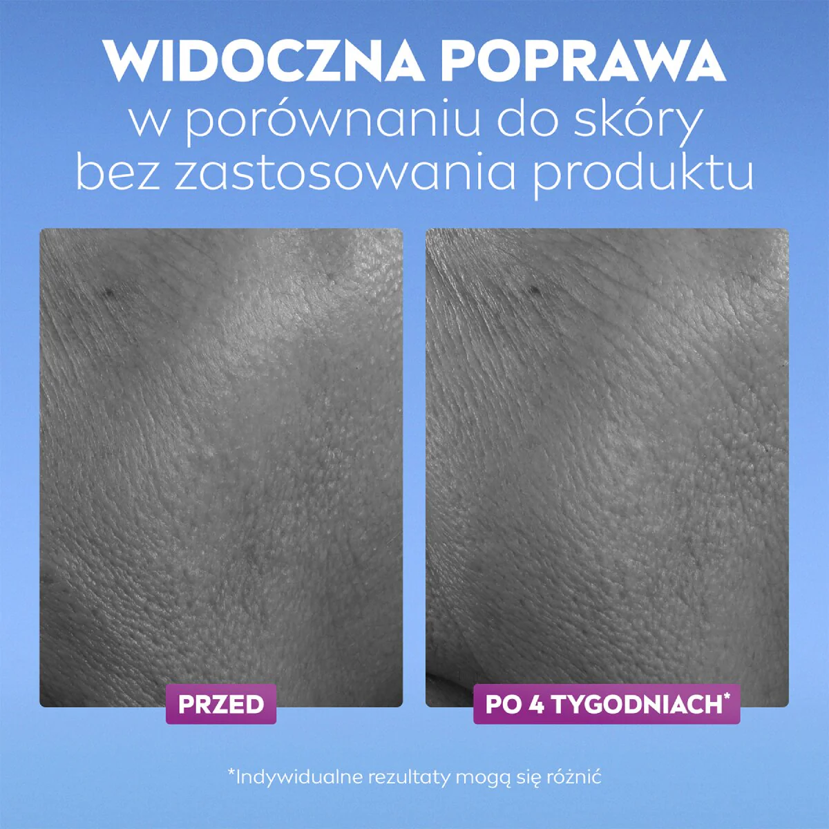 Zdjęcie produktu 5